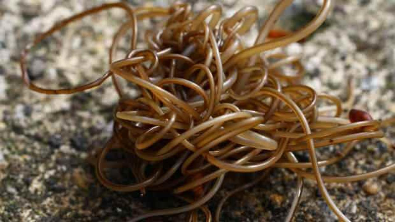 Kıl kurdu nasıl dökülür? Yetişkinlerde kıl kurdu belirtileri: Kıl kurdu nasıl tedavi edilir?