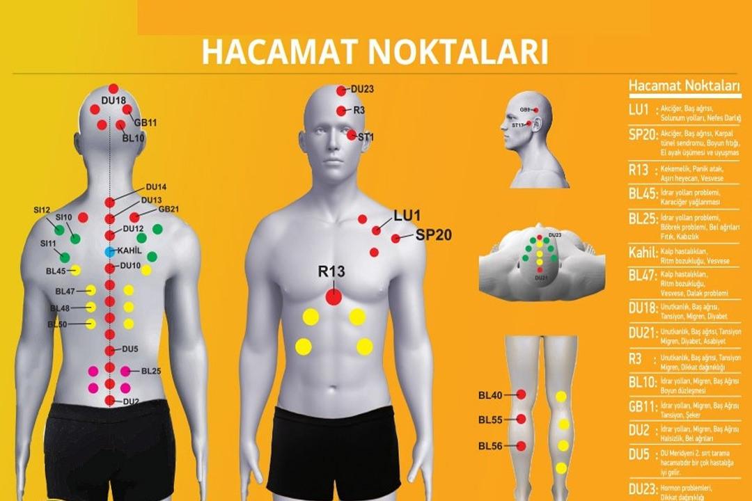 Hacamatın manevi sırları: Hacamat bölgeleri ve faydaları nelerdir? 2023 Hacamat takvimi..