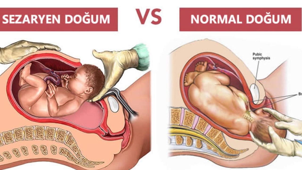 Normal doğumun 10 maddede sağlığa faydaları: Normal doğumun vücudu yeniler mi?