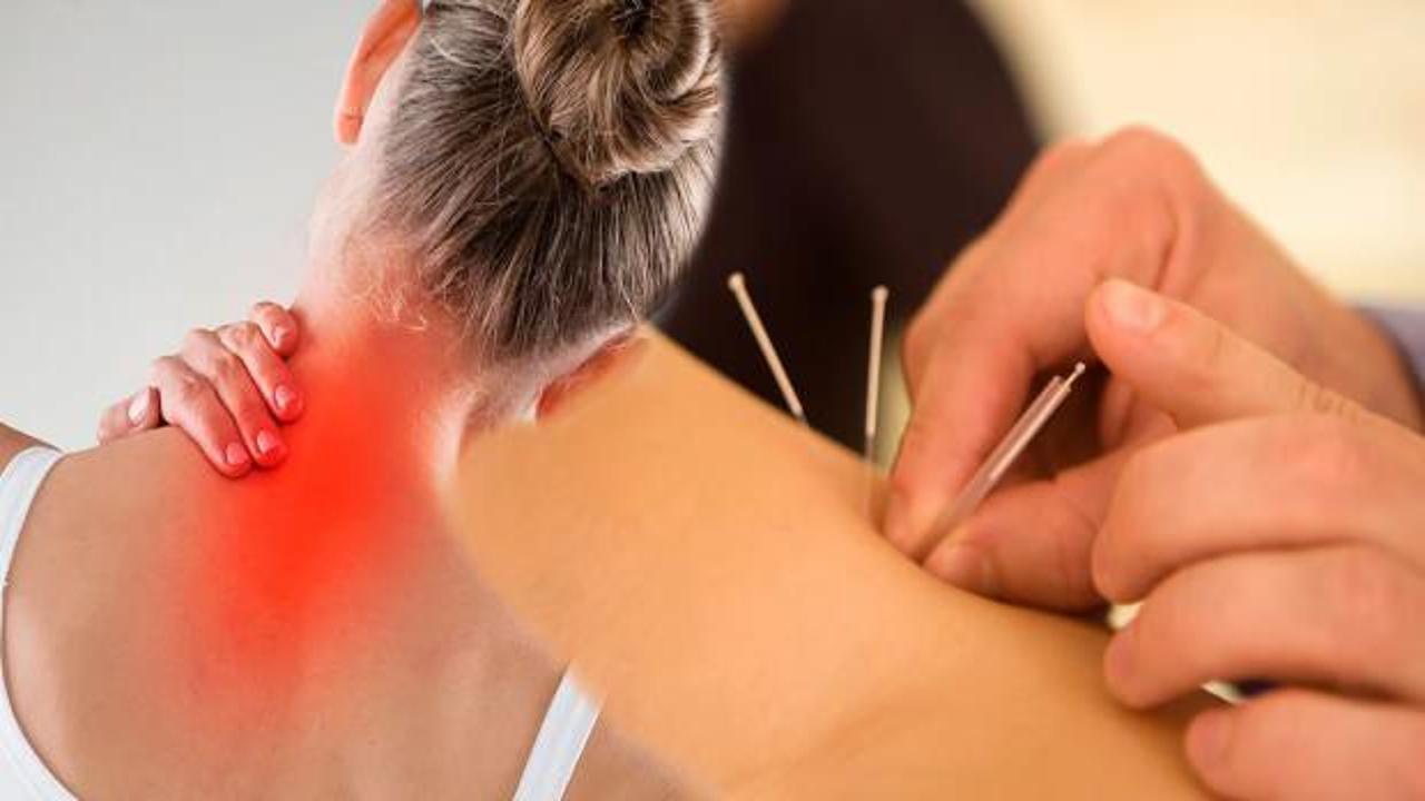 Fibromiyalji tedavisi ve ağrı noktaları: Fibromiyalji kuru iğne tedavisi nedir?