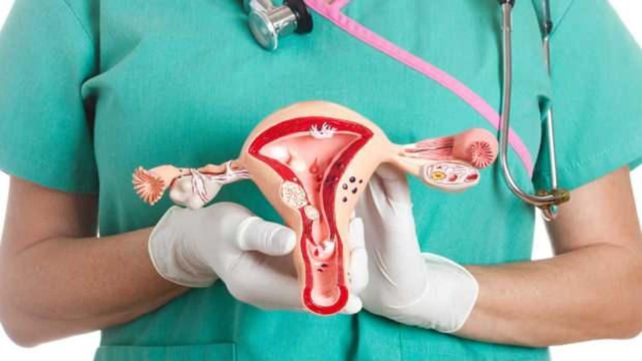 Miyom nedir, belirtileri nelerdir? Rahimde miyom tehlikeli mi?