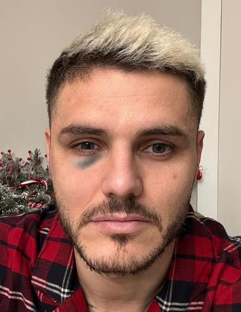 Galatasaray'da Mauro Icardi çılgına döndü! Fenerbahçe derbisi sonrası zor tuttular