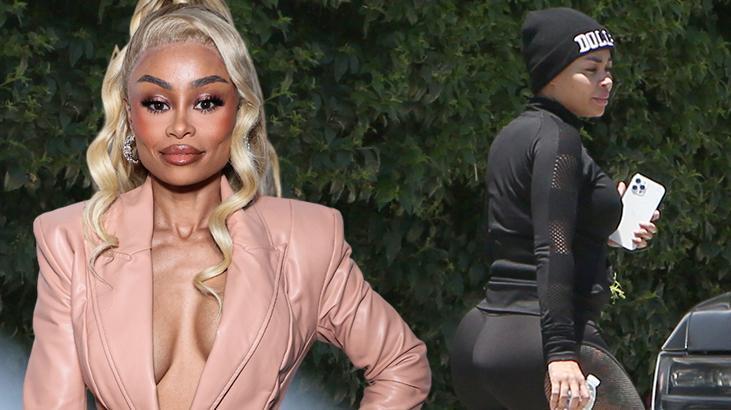 Göğüslerini küçülttü, kabusu yaşadı! ‘Olabilecek en kötü şeylerden biri oldu’