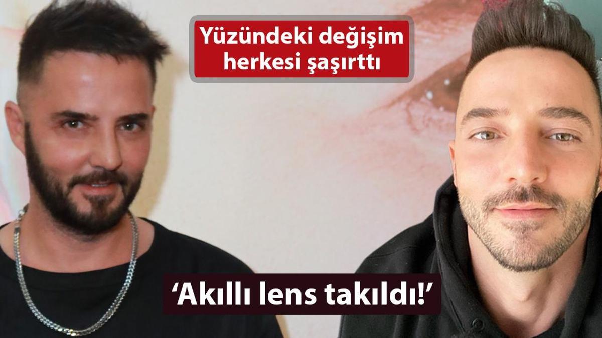 Gökhan Özen’in yüzündeki değişim dikkat çekti! ‘Akıllı lens takıldı’