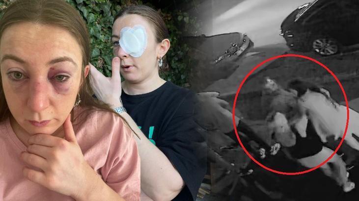 Hayatını kabusa çevirdi, ne yaptıysa kurtulamadı:Vücudumda defalarca sigara söndürdü