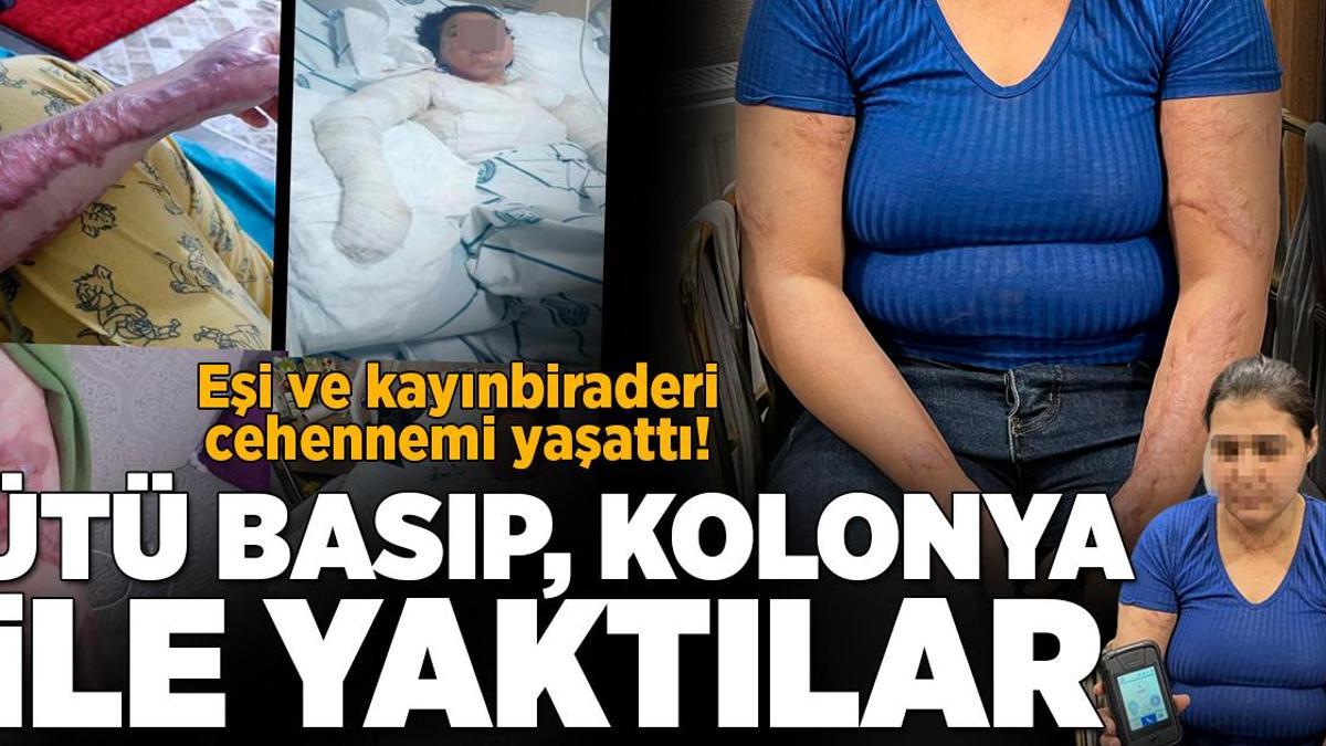 Yazgül’ün dramı! Eşi ve kayıbiraderi ütü basıp, kolonyayla yakmaya çalıştı