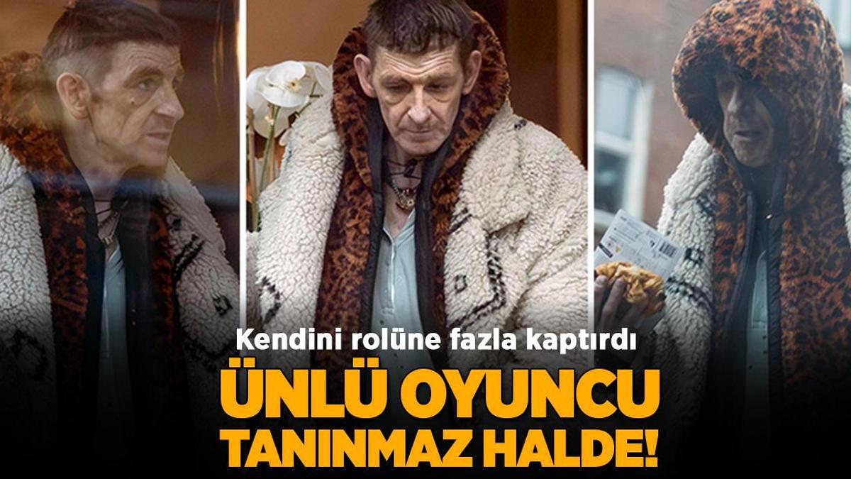 ‘Peaky Blinders’ın yıldızı tanınmaz halde! Uyuşturucu bağımlılığıyla mı mücadele ediyor?