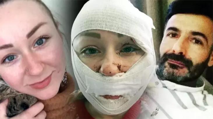 Boşanmak isteyen eşini bu hale getirmişti! İkinci kez yargılanan sanık hakkında karar