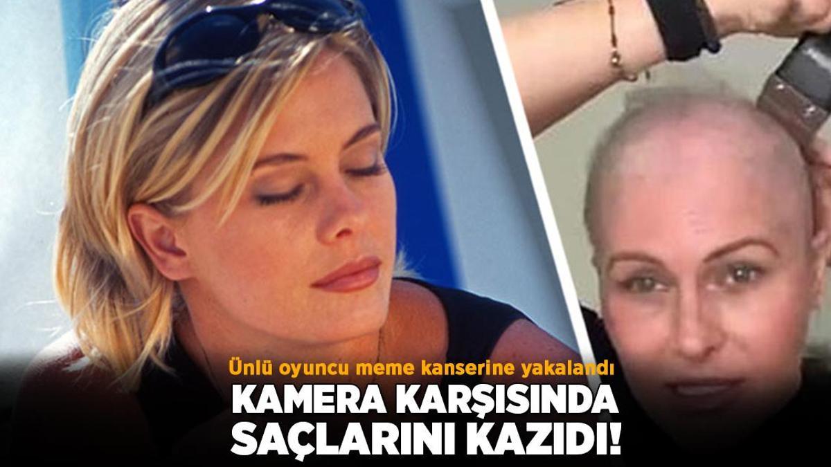 Kansere yakalanan ünlü oyuncudan duygusal paylaşım! Saçlarını kendisi kazıdı
