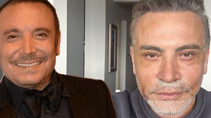 Cenk Eren yüzüne estetik yaptırdı: Nerelerdesin diye sorup duruyordunuz