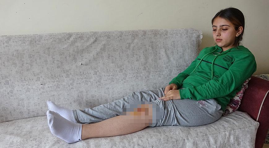 Sokak köpekleri dehşet saçtı! Liseli Özge kabusu yaşadı