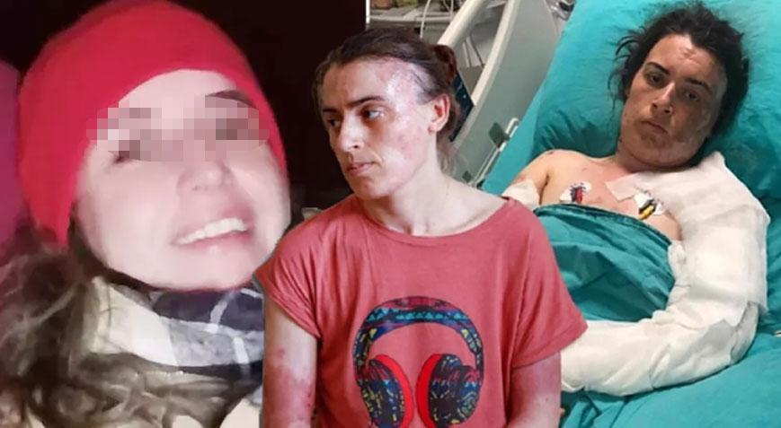 Önce bıçakladı sonra kaynar suyla yaktı! Elti teröründe karar