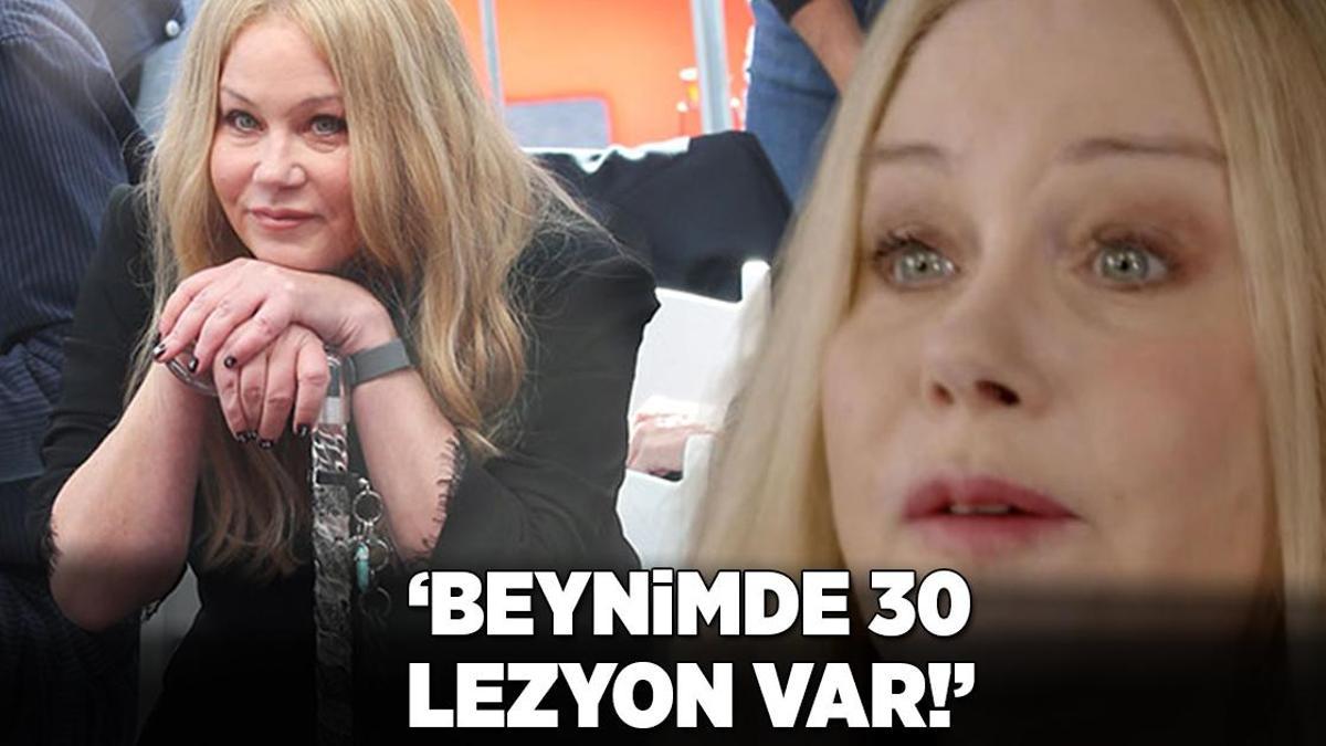 MS’le mücadele eden ünlü oyuncu açıkladı: Beynimde 30 lezyon var!
