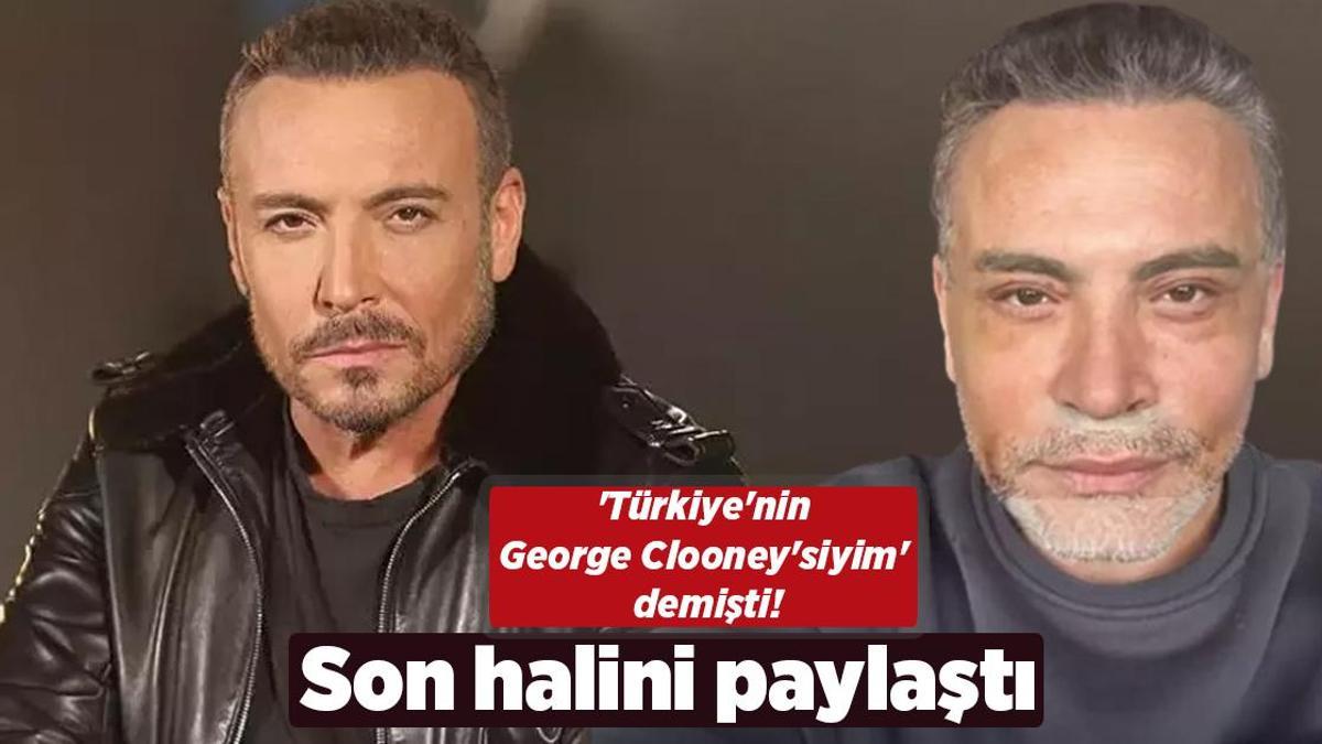 ‘Türkiye’nin George Clooney’siyim’ demişti! Yüzünü gerdiren Cenk Eren son halini paylaştı