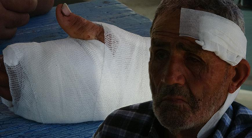 72 yaşındaki çoban dehşeti yaşadı! ‘Önce koyunlara sonra bana saldırdı’