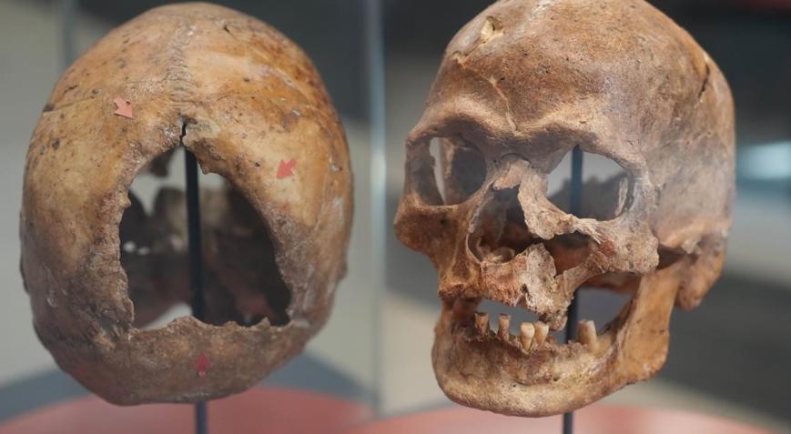 Herkesi şoke eden ameliyat izleri! ‘Birçok kişinin ölümüyle sonuçlandı’