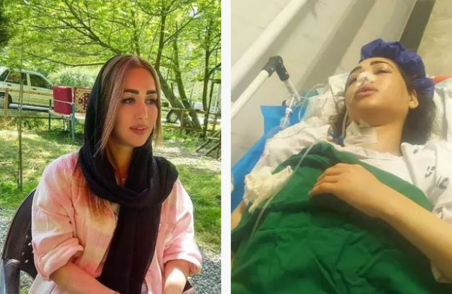 Başörtüsü Kuralını Çiğneyen Kadın Polis Müdahalesiyle Yaralandı