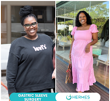 Gugu Gumede’nin İstanbul’da Geçirdiği Tüp Mide Ameliyatı: Detaylar