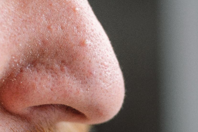 Burun kıllarını asla kökten almayın: Hayati tehlike oluşturuyor