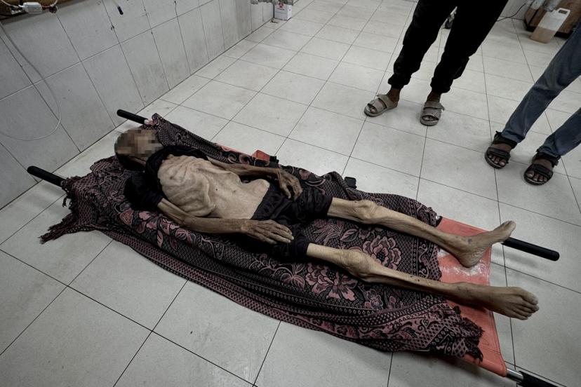 Gazze’de açlık can almaya devam ediyor: 5 Filistinli daha hayatını kaybetti