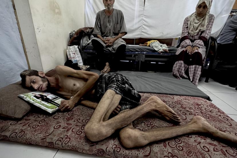 Gazze’de yardım arayışı yaşam mücadelesine dönüştü: İsrail’in saldırısında başından vuruldu