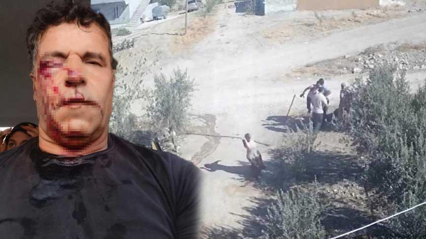 Şanlıurfa’da Su Kuyusu Kavgası: Amca Çocukları Taşla Saldırdı