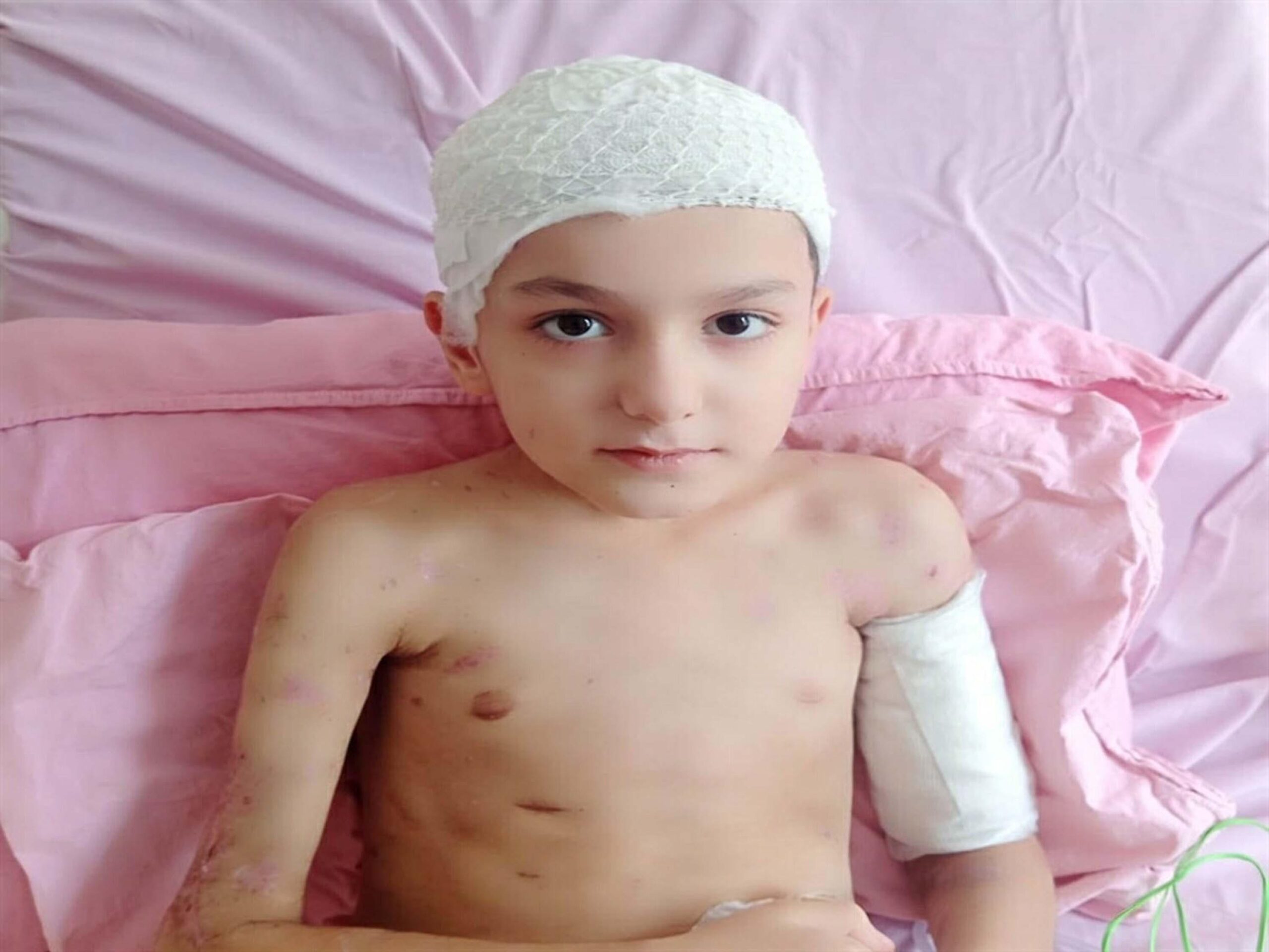 Sokak Köpeği Saldırısında Emsal Karar: 10 Yaşındaki Çocuğa 5 Milyon Lira Manevi Tazminat