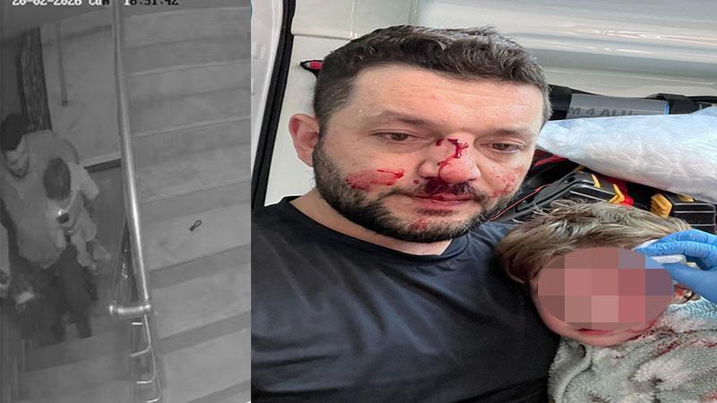 Esenköy’de Komşu Kavgası: Bebek Yaralandı, Davada Tahliye Kararı
